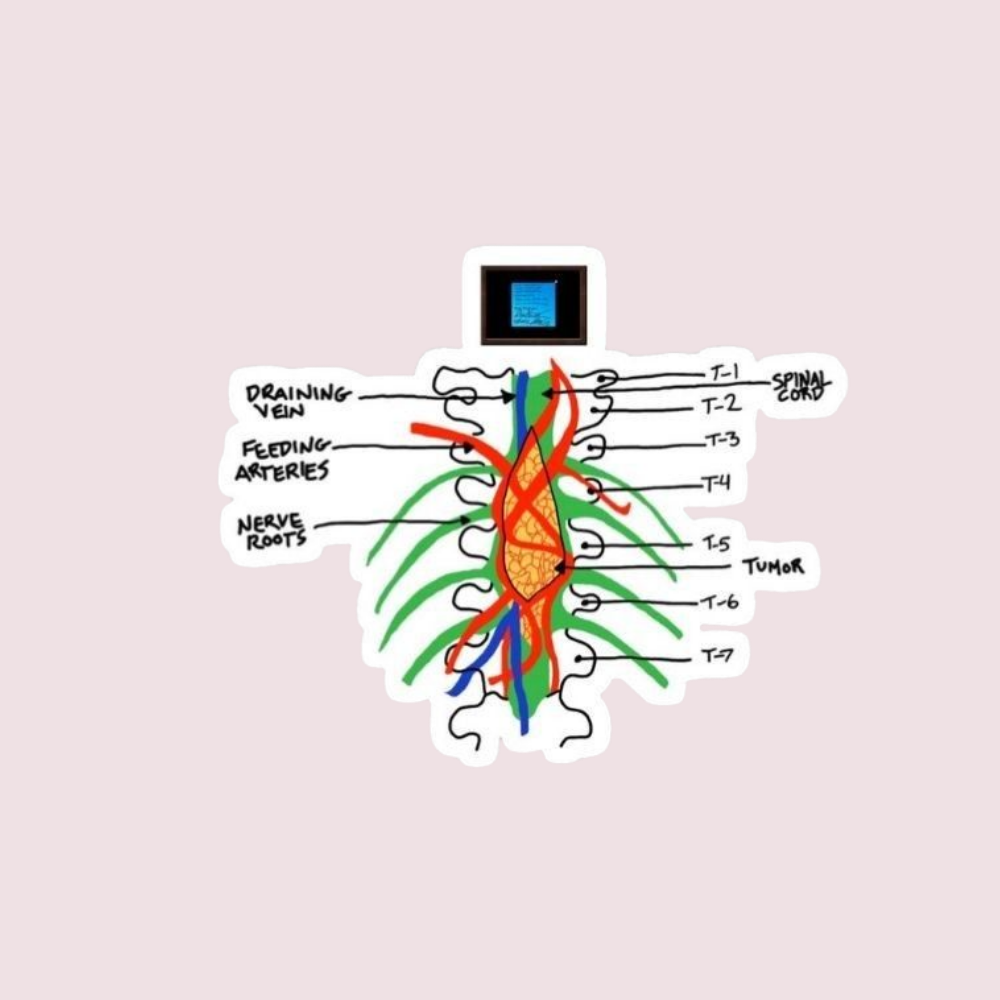 Stickers Series - Tumor espinal grey's anatomy