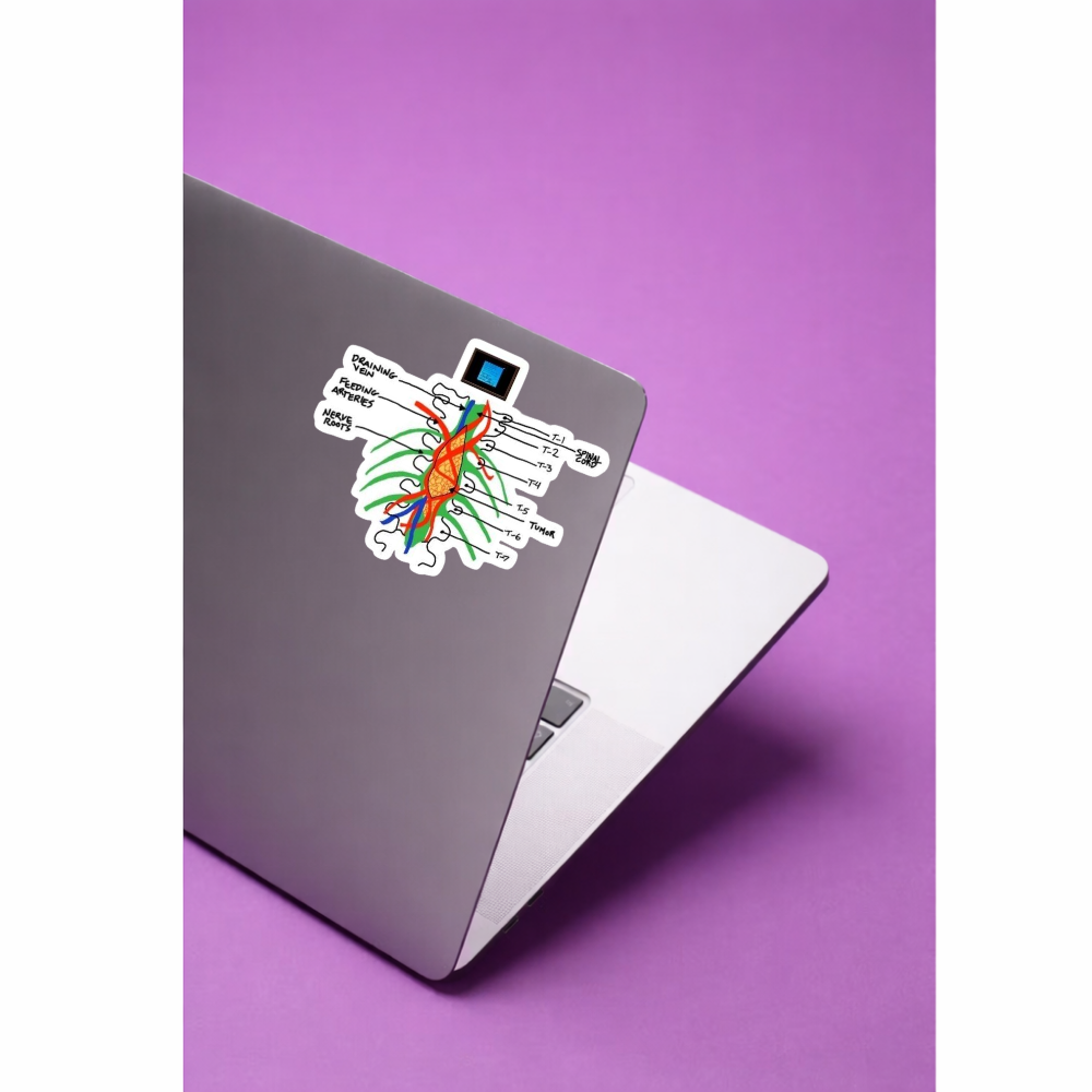 Stickers Series - Tumor espinal grey's anatomy